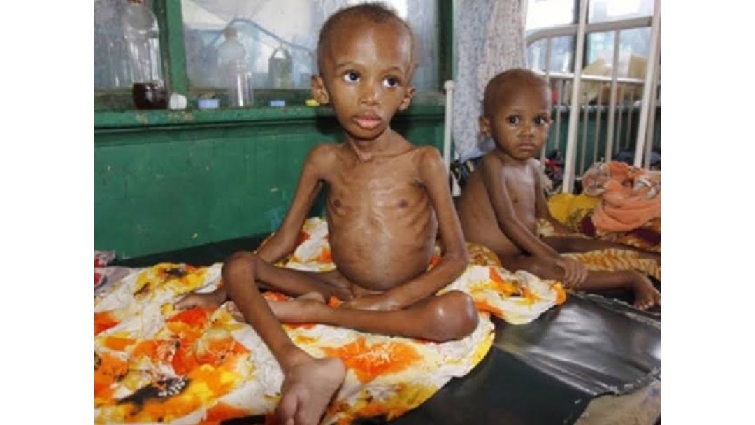 Featured image: A Child’s Cry: Nigeria’s malnutrition crisis demands urgent action